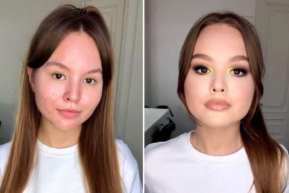 CERA TRĄDZIKOWA – JAK ZAKRYĆ NIEDOSKONAŁOŚCI?